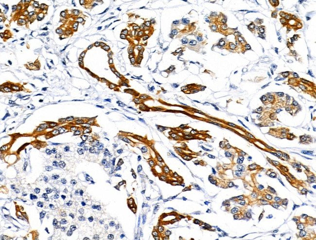 Phospho-Cytokeratin 18 (Ser53) Antibody in Immunohistochemistry (Paraffin) (IHC (P))