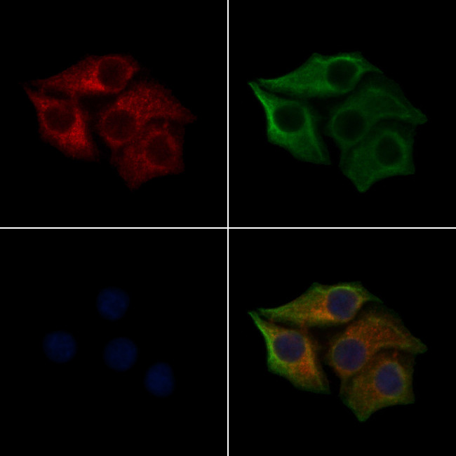 Phospho-Cytokeratin 8 (Ser432) Antibody in Immunocytochemistry (ICC/IF)