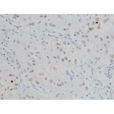 Phospho-Histone H2A.X (Ser140) Antibody in Immunohistochemistry (Paraffin) (IHC (P))