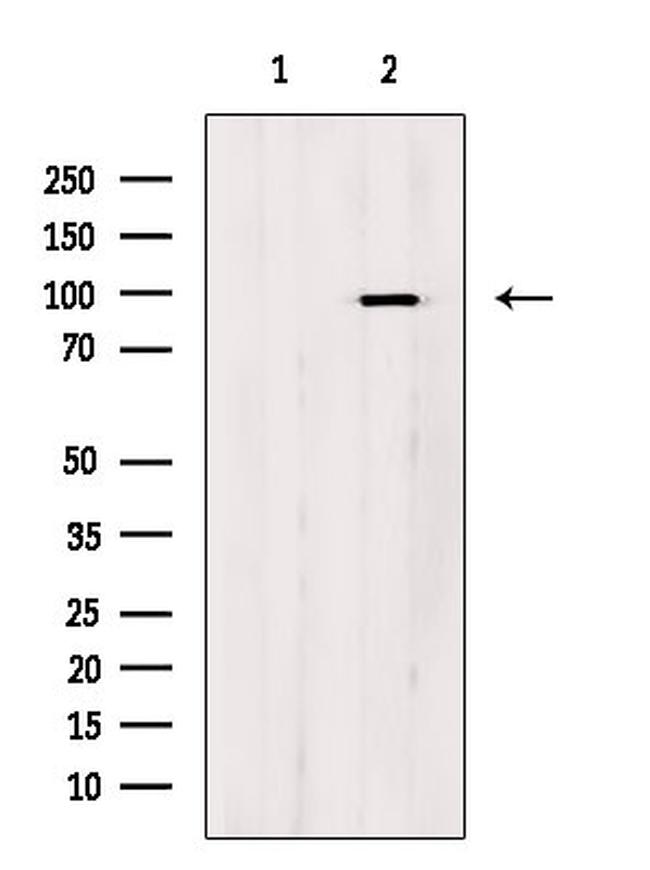 Phospho-HMGCR (Ser872) Antibody in Western Blot (WB)