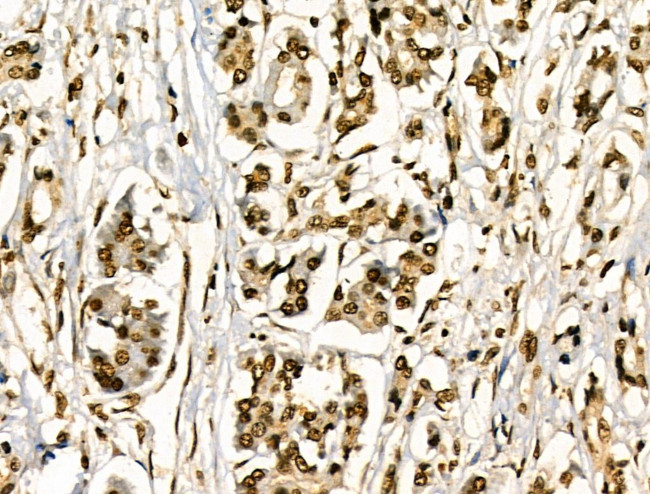 Phospho-HSP27 (Ser78) Antibody in Immunohistochemistry (Paraffin) (IHC (P))