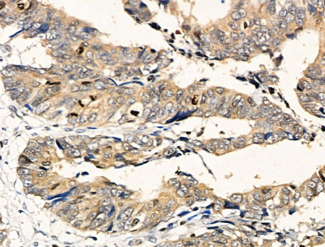 Phospho-HSP90 (Tyr627) Antibody in Immunohistochemistry (Paraffin) (IHC (P))