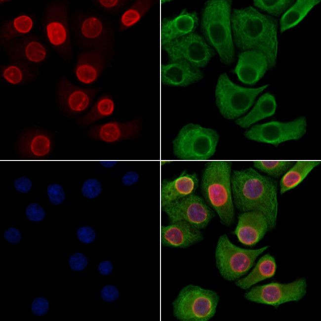 Phospho-Lamin A/C (Ser390) Antibody in Immunocytochemistry (ICC/IF)