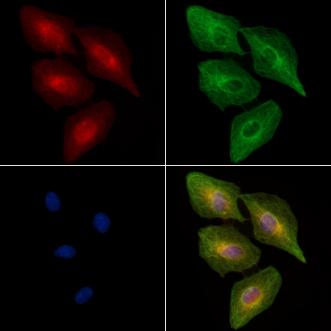 Phospho-TPL2 (Ser443) Antibody in Immunocytochemistry (ICC/IF)