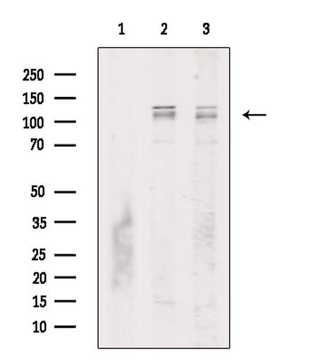 Phospho-ZCWCC1 (Ser615) Antibody in Western Blot (WB)