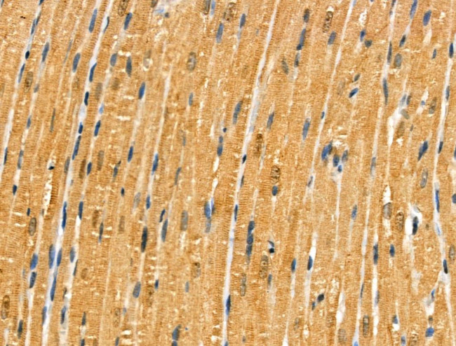 Phospho-MYPT1 (Ser473) Antibody in Immunohistochemistry (Paraffin) (IHC (P))