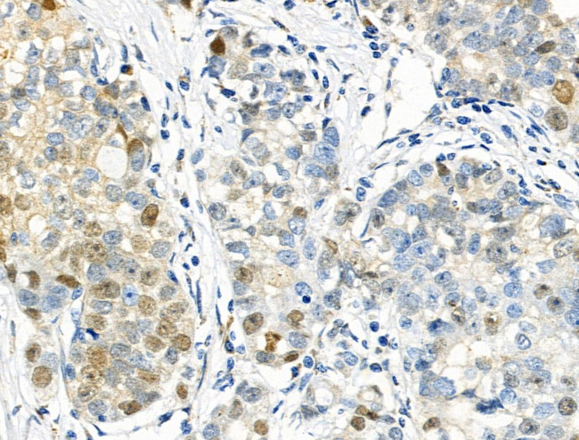 Phospho-p57 Kip2 (Thr310) Antibody in Immunohistochemistry (Paraffin) (IHC (P))