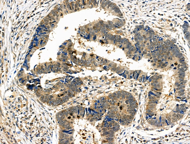 Phospho-PAK4/6/7 (Ser474) Antibody in Immunohistochemistry (Paraffin) (IHC (P))