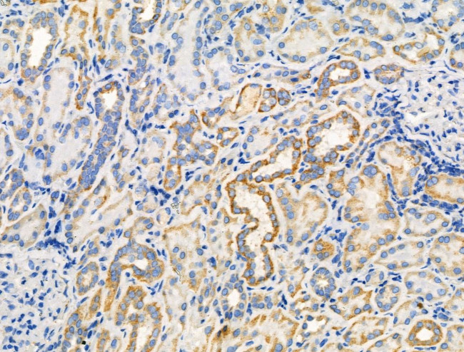 Phospho-Paxillin (Ser272) Antibody in Immunohistochemistry (Paraffin) (IHC (P))