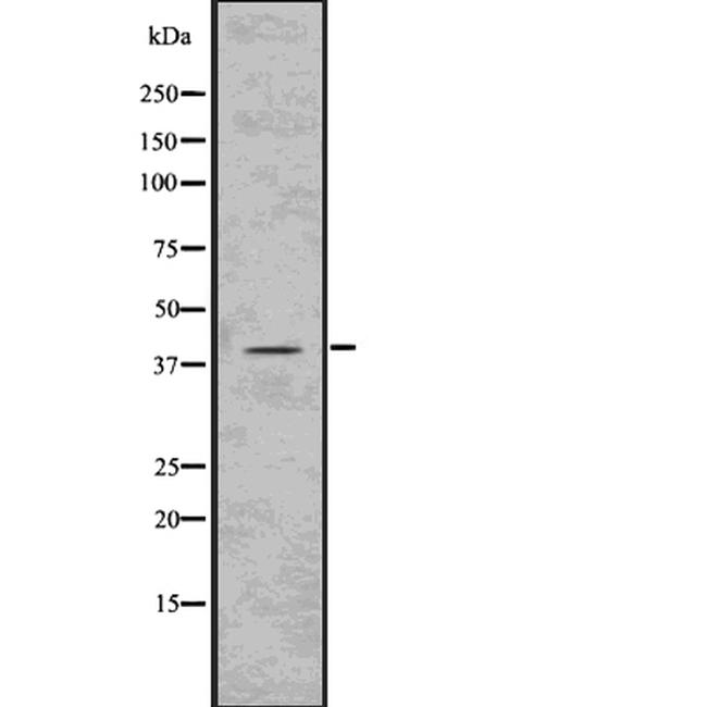 Phospho-PKA beta (Thr198) Antibody in Western Blot (WB)