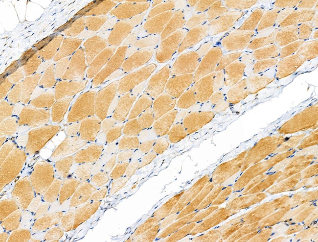Phospho-PYGL (Ser15) Antibody in Immunohistochemistry (Paraffin) (IHC (P))