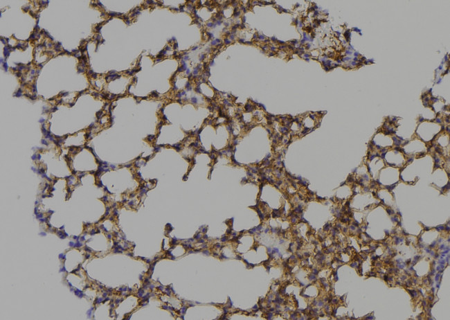 Phospho-MPZL1 (Tyr263) Antibody in Immunohistochemistry (Paraffin) (IHC (P))