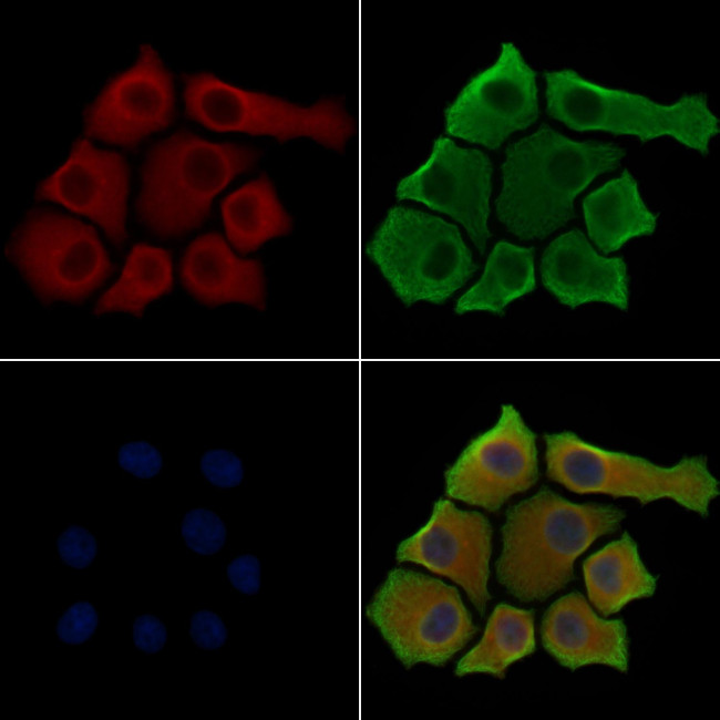Phospho-RAB29 (Thr71) Antibody in Immunocytochemistry (ICC/IF)
