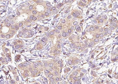 Phospho-SHP2 (Tyr542) Antibody in Immunohistochemistry (Paraffin) (IHC (P))
