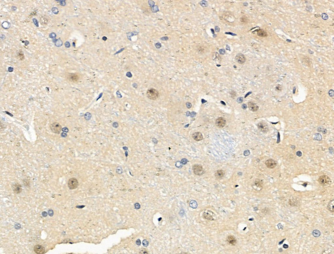 Phospho-MAPKAP1 (Thr86) Antibody in Immunohistochemistry (Paraffin) (IHC (P))