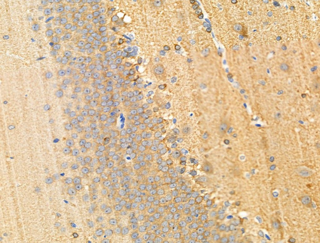 Phospho-Tau (Ser516) Antibody in Immunohistochemistry (Paraffin) (IHC (P))