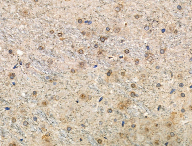 Phospho-Tau (Thr492, Thr175) Antibody in Immunohistochemistry (Paraffin) (IHC (P))