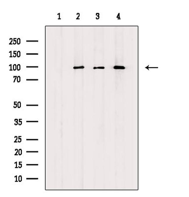 Phospho-TLR3 (Tyr858) Antibody in Western Blot (WB)