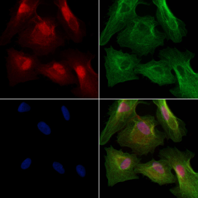 Phospho-TOPBP1 (Ser1138) Antibody in Immunocytochemistry (ICC/IF)
