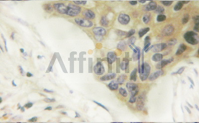 Phospho-Vimentin (Ser56) Antibody in Immunohistochemistry (Paraffin) (IHC (P))