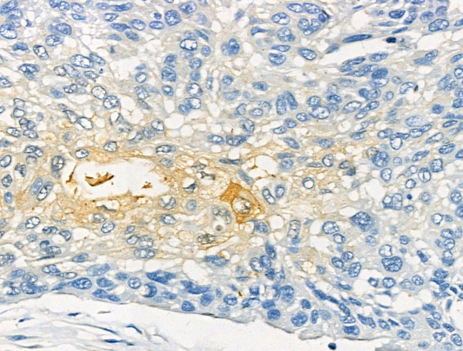 Phospho-XIRP1 (Ser295) Antibody in Immunohistochemistry (Paraffin) (IHC (P))