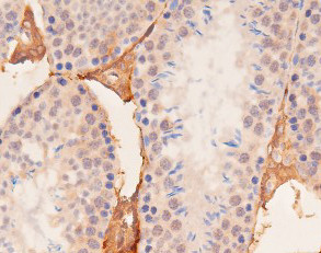 Phospho-YAP1 (Ser127) Antibody in Immunohistochemistry (Paraffin) (IHC (P))