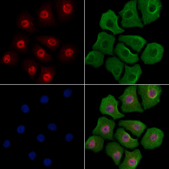 Phospho-YY1 (Ser365) Antibody in Immunocytochemistry (ICC/IF)