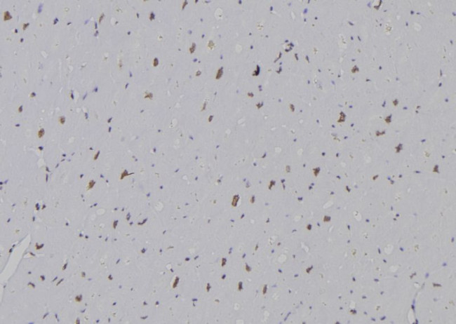H3K36me2 Antibody in Immunohistochemistry (Paraffin) (IHC (P))