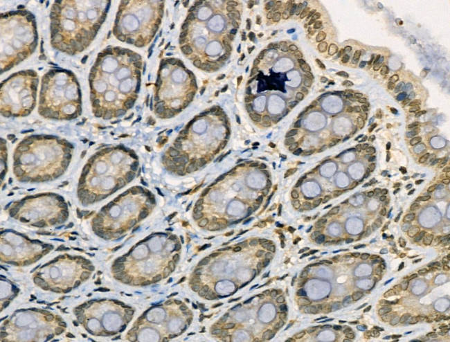 Acetyl-NFkB p65 (Lys314, Lys315) Antibody in Immunohistochemistry (Paraffin) (IHC (P))