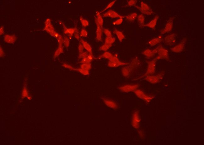 Blimp-1 Antibody in Immunocytochemistry (ICC/IF)