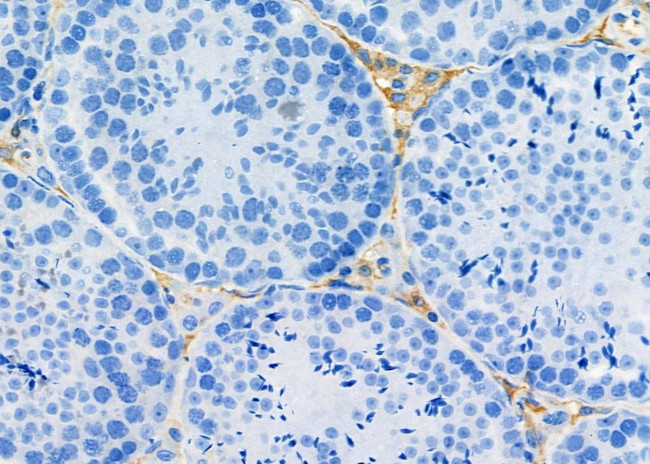 Rex1 Antibody in Immunohistochemistry (Paraffin) (IHC (P))