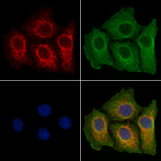 ADCY2 Antibody in Immunocytochemistry (ICC/IF)