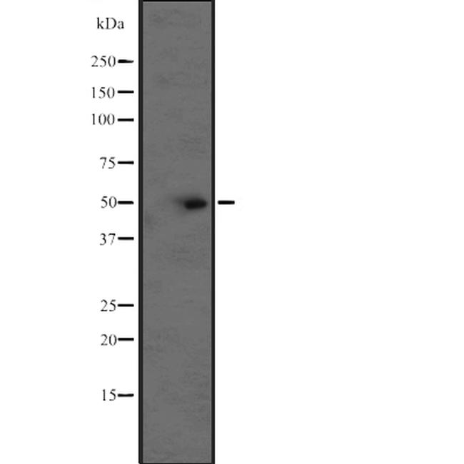 Bcl-rambo Antibody in Western Blot (WB)