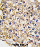 TRPV3 Antibody in Immunohistochemistry (Paraffin) (IHC (P))