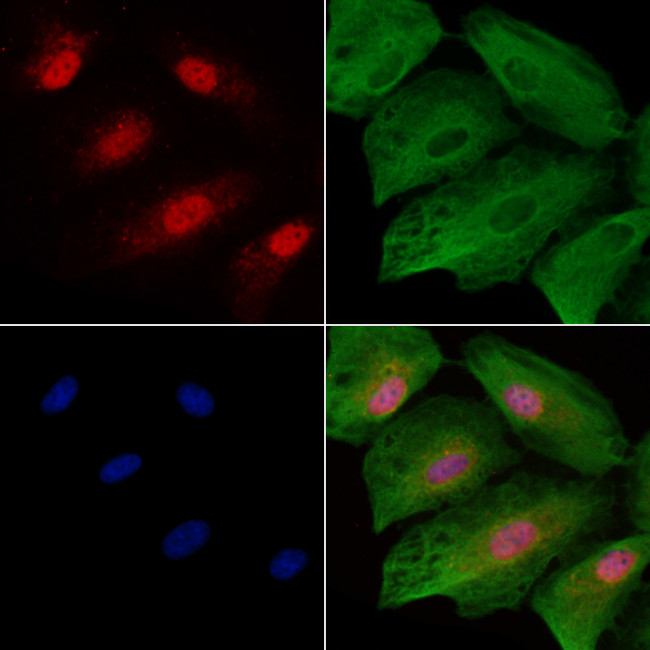 CIRBP Antibody in Immunocytochemistry (ICC/IF)