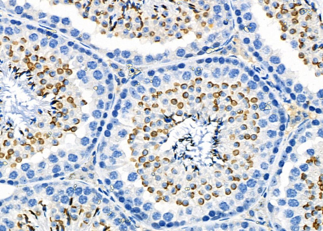 CITED4 Antibody in Immunohistochemistry (Paraffin) (IHC (P))