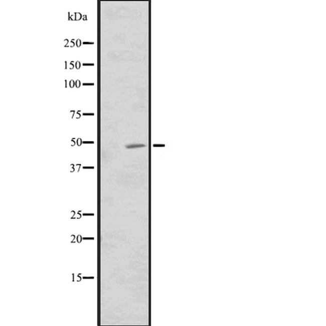 CNNM3 Antibody in Western Blot (WB)