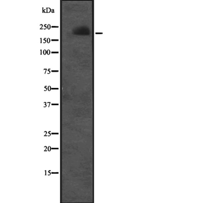 Cullin 7 Antibody in Western Blot (WB)