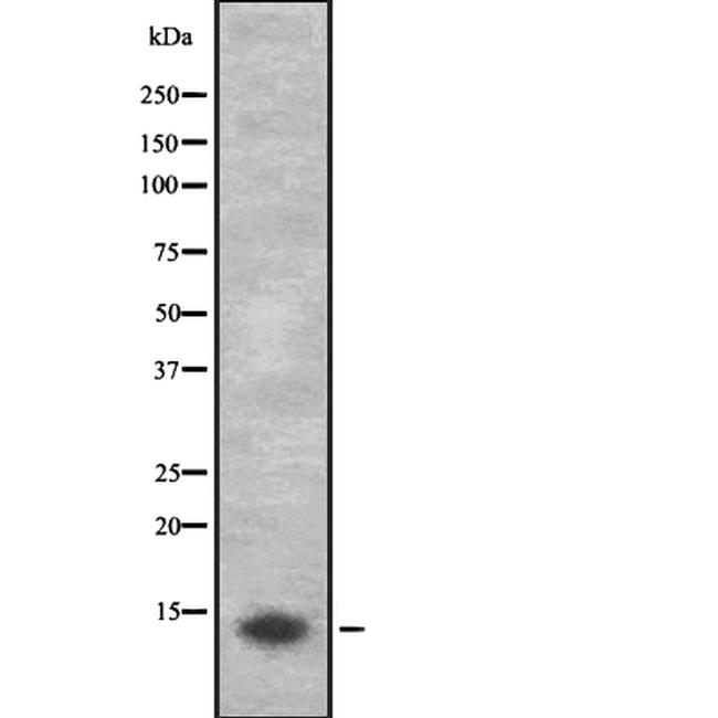 CYP3A43 Antibody in Western Blot (WB)