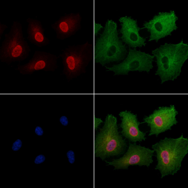 DDB2 Antibody in Immunocytochemistry (ICC/IF)