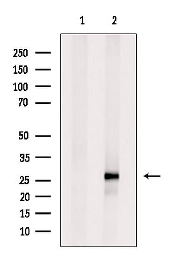 DIRAS3 Antibody in Western Blot (WB)