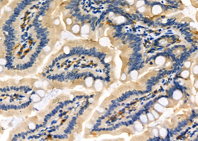 FN3K Antibody in Immunohistochemistry (Paraffin) (IHC (P))