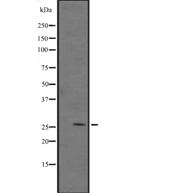 GADD45A Antibody in Western Blot (WB)