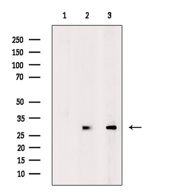 GPR146 Antibody in Western Blot (WB)