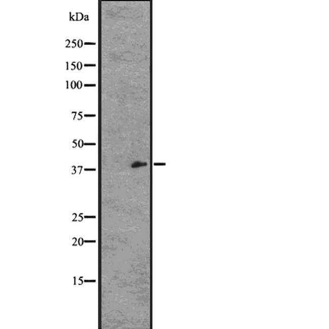 GPR21 Antibody in Western Blot (WB)