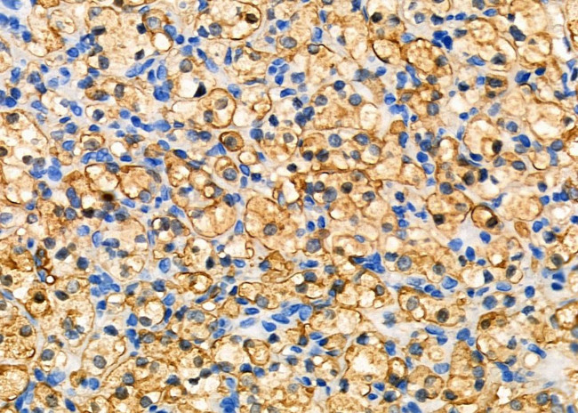 GPR81 Antibody in Immunohistochemistry (Paraffin) (IHC (P))