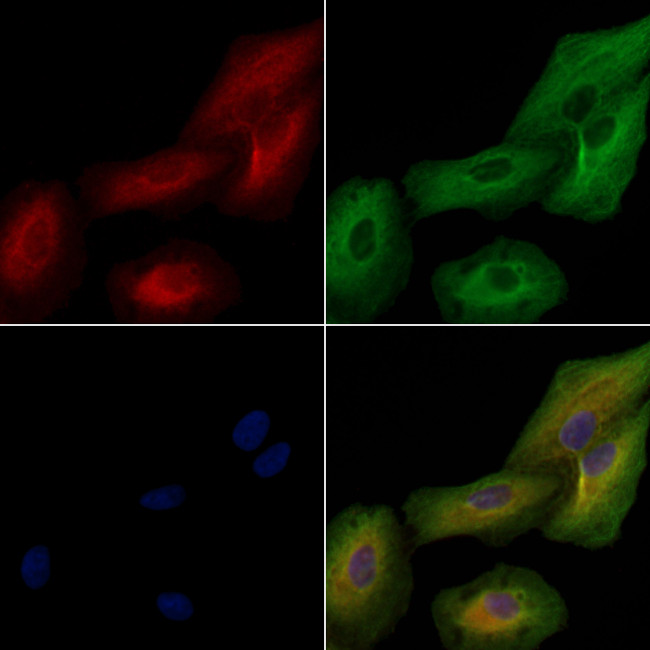 IL1F5 Antibody in Immunocytochemistry (ICC/IF)