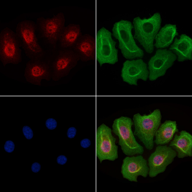 JMJD1B Antibody in Immunocytochemistry (ICC/IF)