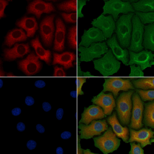 Cytokeratin 1 Antibody in Immunocytochemistry (ICC/IF)