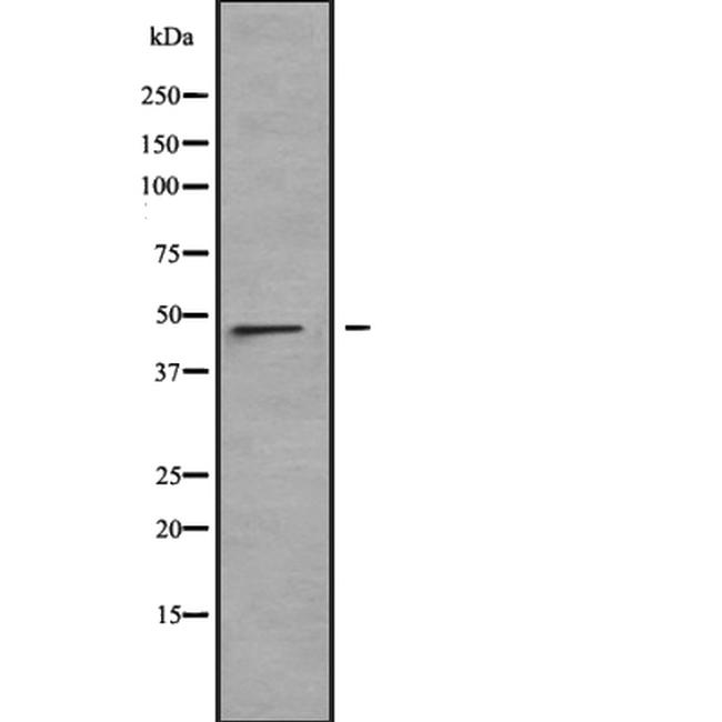 LRRC42 Antibody in Western Blot (WB)